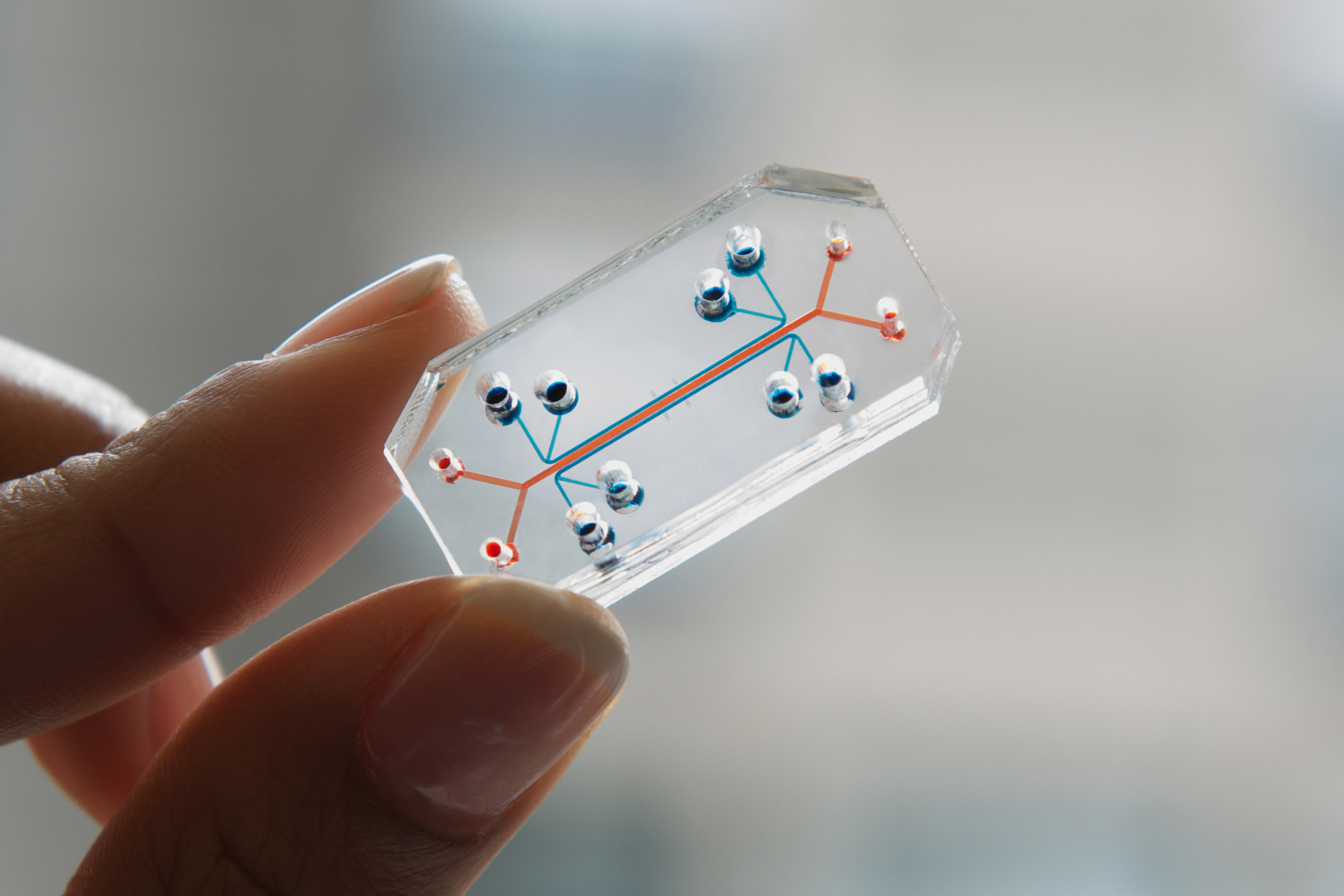 A lung-on-a-chip microfluidic device.